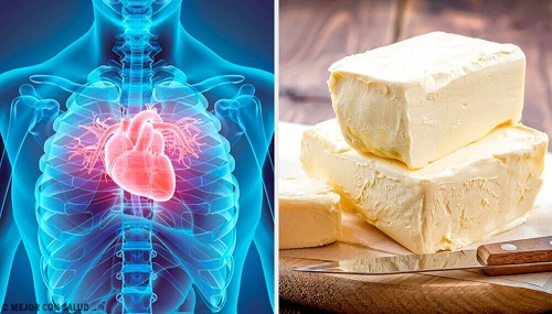5 alimente nocive pentru inimă