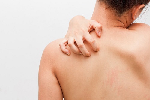 Problemele dermatologice pe lista de semne care indică o problemă intestinală