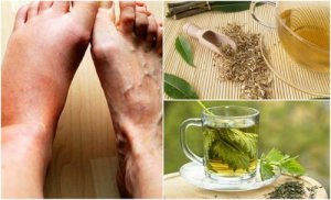 5 remedii care scad nivelul de acid uric din organism