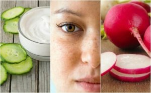 5 remedii naturiste pentru petele de pe față
