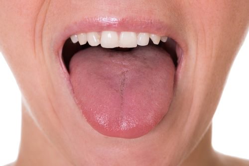5 simptome inițiale ale cancerului limbii