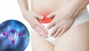 Cauzele, simptomele și tratamentul endometriozei