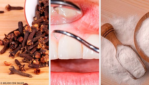 5 remedii naturiste pentru gingiile inflamate 5 remedii naturiste pentru gingiile inflamate