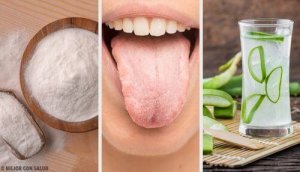 8 remedii naturale pentru limba albicioasă