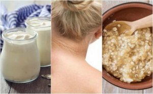5 remedii pentru petele închise de pe gât