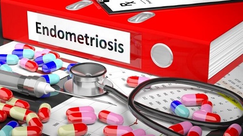 Simptomele și tratamentul endometriozei cu medicamente