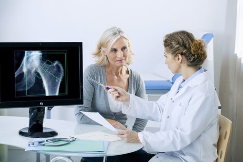 Medic oferind informații esențiale despre osteoporoză