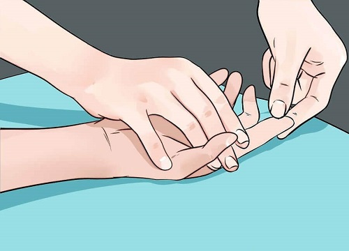 provoacă umflarea mâinilor cu dureri articulare