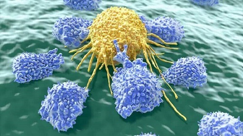 Scaune deschise la culoare sau albe cauzate de cancer