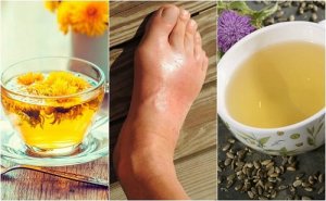 5 ceaiuri pentru reducerea nivelului de acid uric