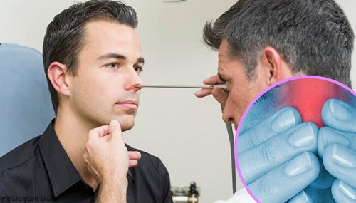Medic recomandând rețete cu sfeclă pentru îmbunătățirea sănătății