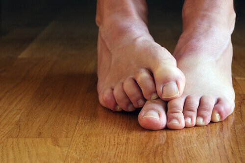 Nevoia de tratamente naturale pentru problemele unghiilor de la picioare