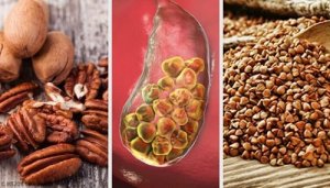 6 alimente care combat calculii biliari