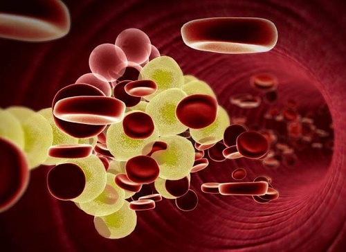 Beneficii ale coriandrului pentru colesterol ridicat în sânge