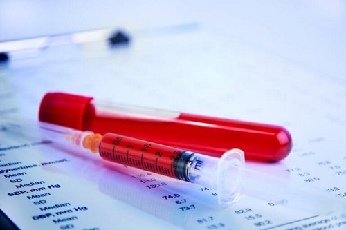 Beneficii ale curcumei în timpul menopauzei precum efectul anticoagulant