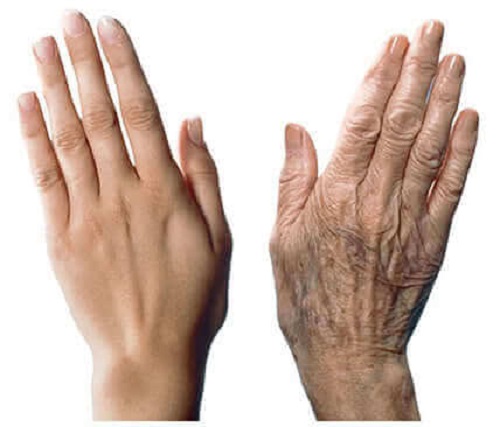 Sfaturi pentru a încetini îmbătrânirea mâinilor