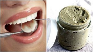 Cum să previi și să tratezi cariile în mod 100% natural