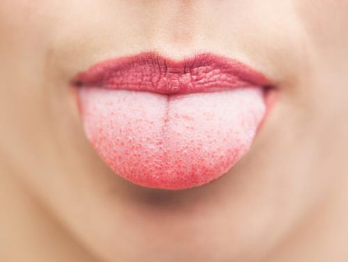 Curățarea limbii pe lista de obiceiuri matinale sănătoase