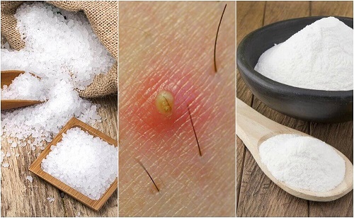 5 soluții naturale pentru firele de păr crescute sub piele