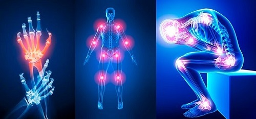 Vitamina D și magneziul protejează oasele împotriva osteoporozei