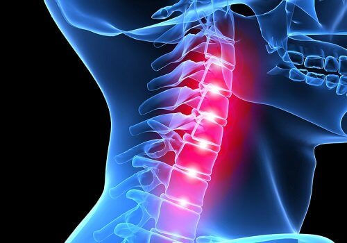 Radiografie revelând efecte ale stresului asupra coloanei vertebrale