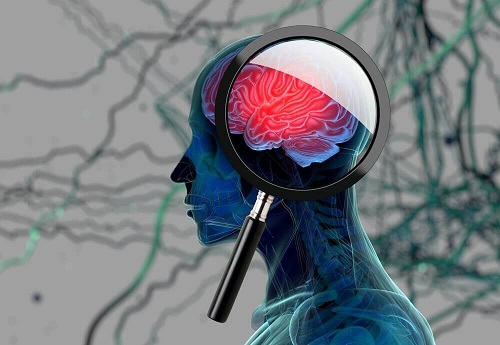 Semnele bolii Alzheimer precum pierderea memoriei