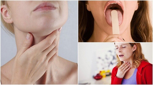 8 simptome timpurii ale cancerului la gât