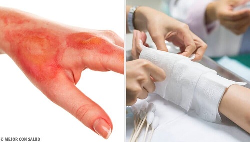 reumatism articular cum se tratează o articulație pe deget doare