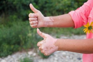 Cel mai bun regim alimentar pentru bolile autoimune