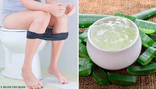 Remedii naturale pentru hemoroizi