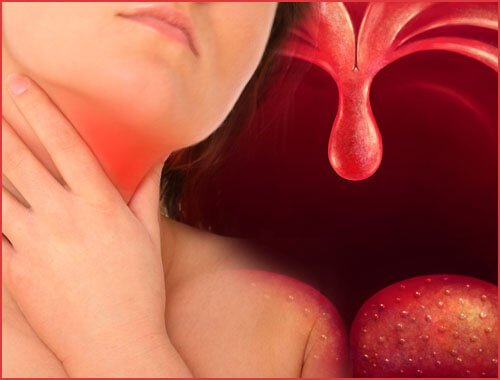 Semne care indică prezența plăcii în gât la bolnavii cu amigdalită