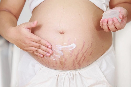 Utilizări cosmetice ale uleiului de cocos precum cea de tratament pentru vergeturi