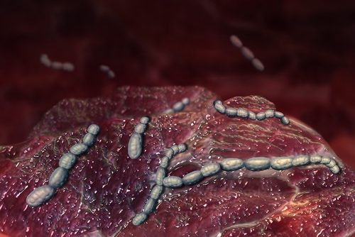 Cauzele și simptomele scarlatinei provocate de bacterii