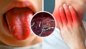 Cauzele și simptomele scarlatinei