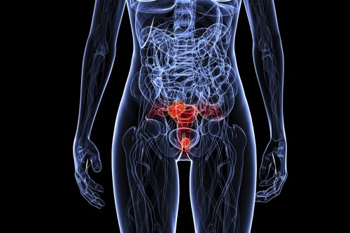 Ce este virusul papiloma uman care afectează organul genital