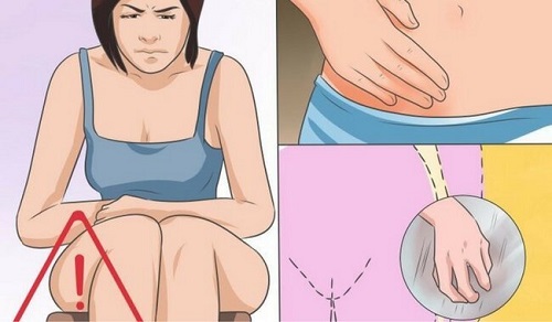 Cauzele și tratamentul candidozei vaginale