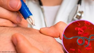 Cele mai importante informații despre boala Lyme