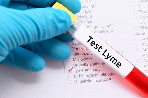 Informații despre boala Lyme și stabilirea unui diagnostic