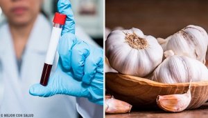 Proprietățile usturoiului - un excelent supliment anticoagulant