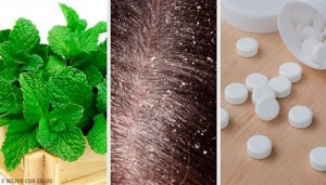 7 remedii naturiste împotriva mătreții