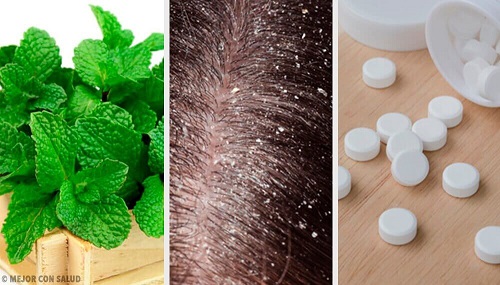 7 remedii naturiste împotriva mătreții