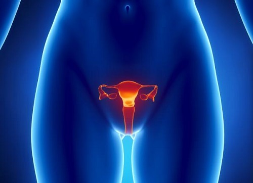 5 simptome timpurii ale cancerului ovarian