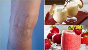 5 sucuri naturale împotriva varicelor