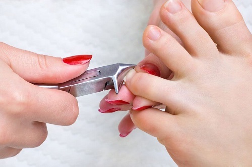 Cum să tratezi piciorul diabetic prin tăierea corectă a unghiilor