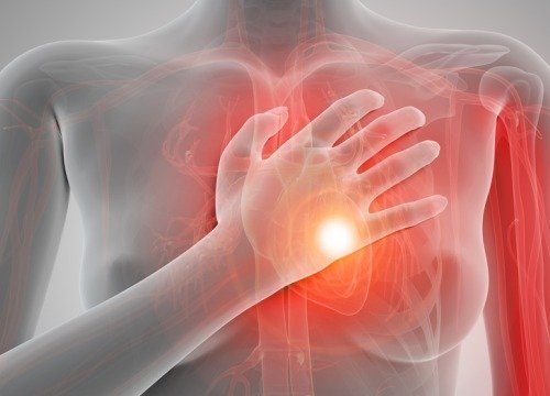 Semne care indică un posibil infarct miocardic la femei