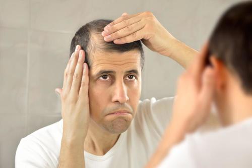 Cum să combați alopecia dacă ești bărbat