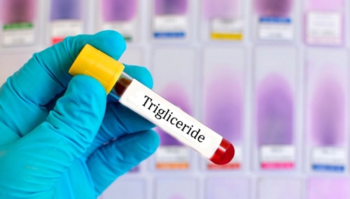 Dietă de 7 zile pentru scăderea trigliceridelor