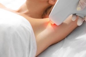 Epilarea definitivă cu laser: mituri și adevăruri