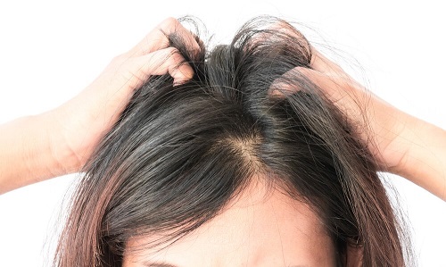 5 remedii împotriva mâncărimii scalpului