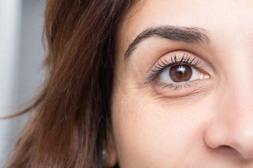 cum să eliminați ridurile și pungile de sub ochi